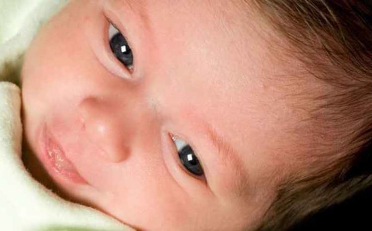  Obstrução do Canal Lacrimal em bebês: O que é? Quais os sintomas?