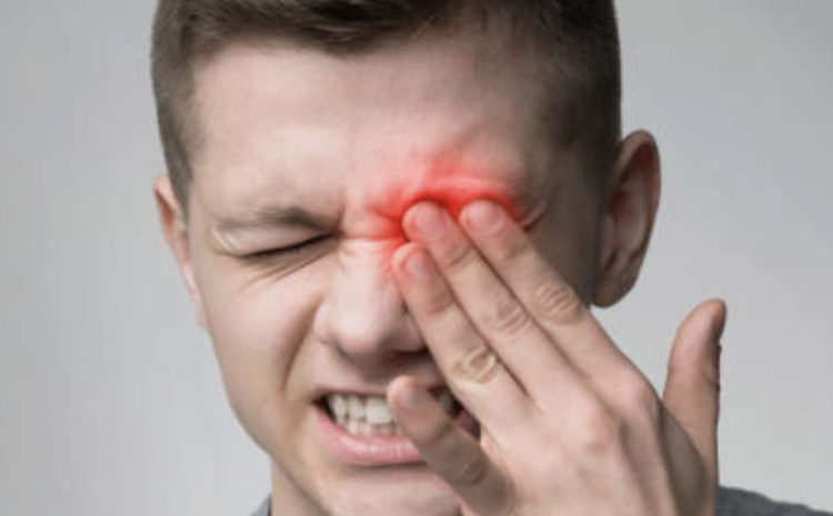  O que é herpes-zóster ocular? Quais os sintomas? Como tratar?