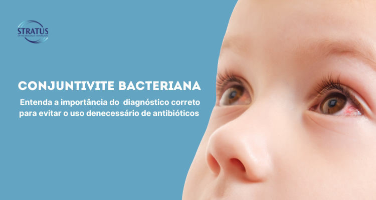  Conjuntivite Bacteriana: Sintomas e Tratamento